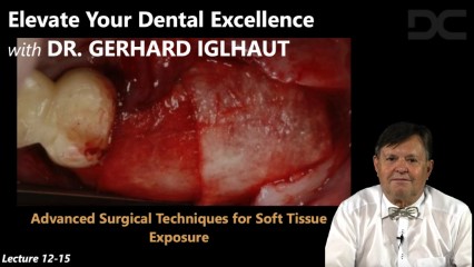 Advanced surgical techniques for soft tissue exposure
